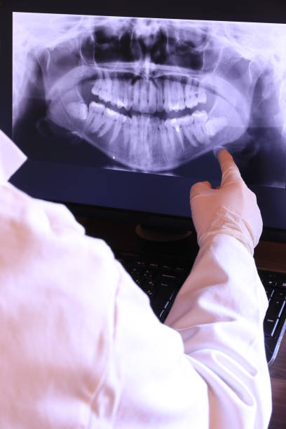 Best Broken or Cracked Tooth Emergency Dentist in Folcroft, PA