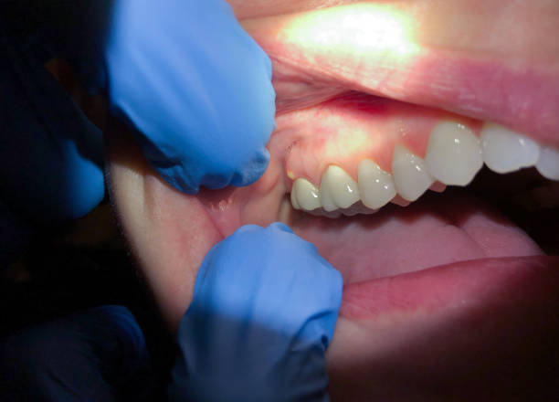 Best Emergency Dentist for Special Needs Patients in Folcroft, PA